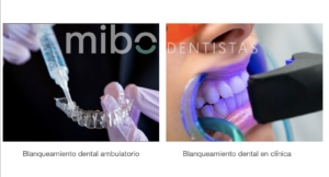 blanqueamiento_dental_almeria